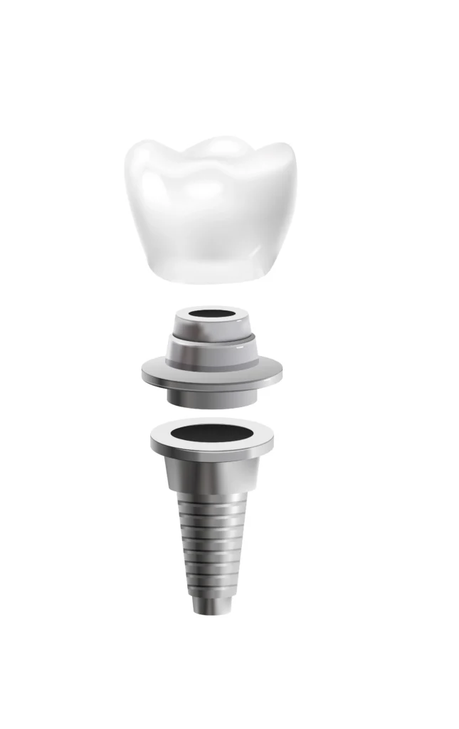 faqs-implantes-dentales