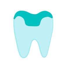 incrustaciones dentales overlay