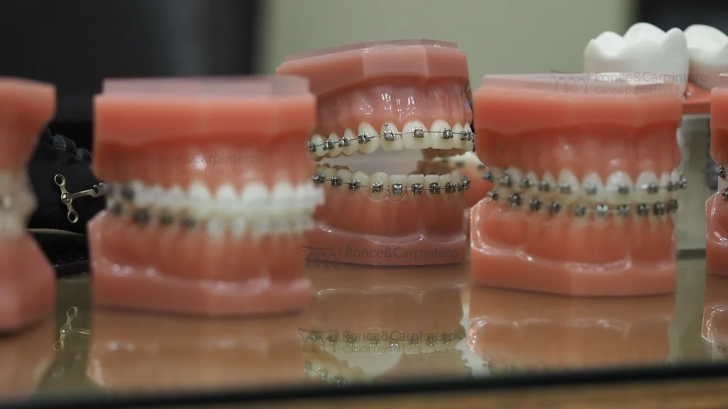 ortodoncias-ponce-y-carpintero